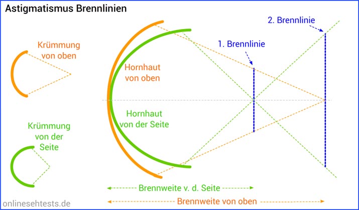 Astigmatismus: Brennpunkte / Brennlinien