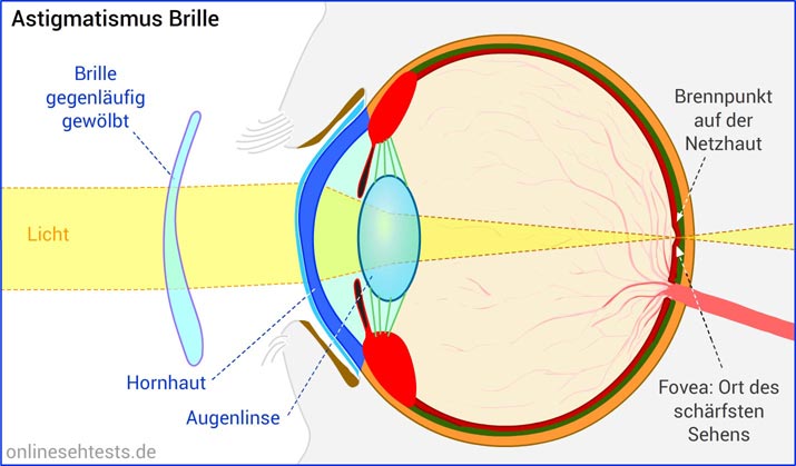 Bitte Anklicken zum Vergrößern Brille bei Astigmatismus