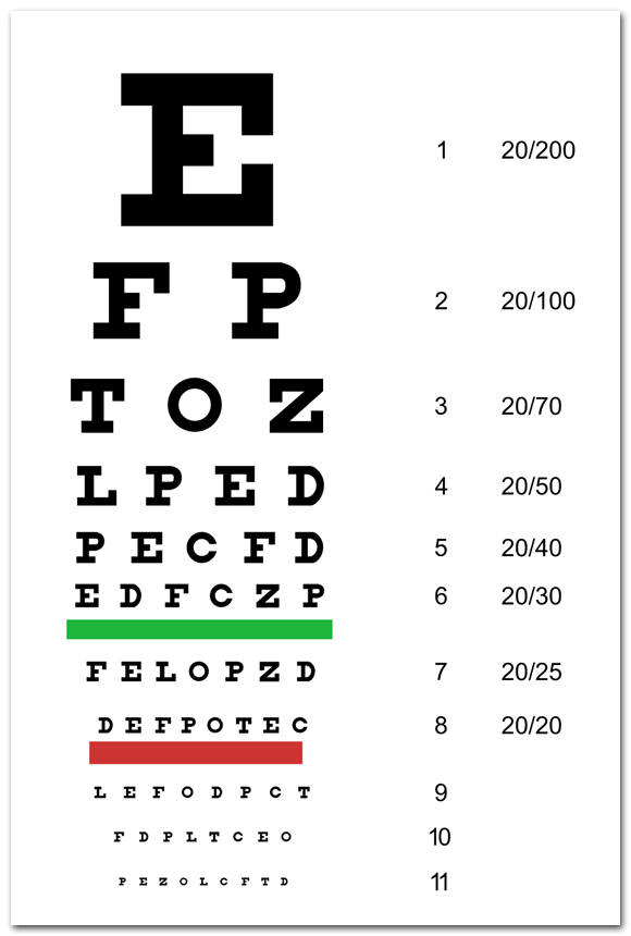 Sehtest (nach Herman Snellen)